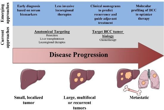 Diseases | Free Full-Text | A Surgical Perspective on Targeted Therapy of  Hepatocellular Carcinoma