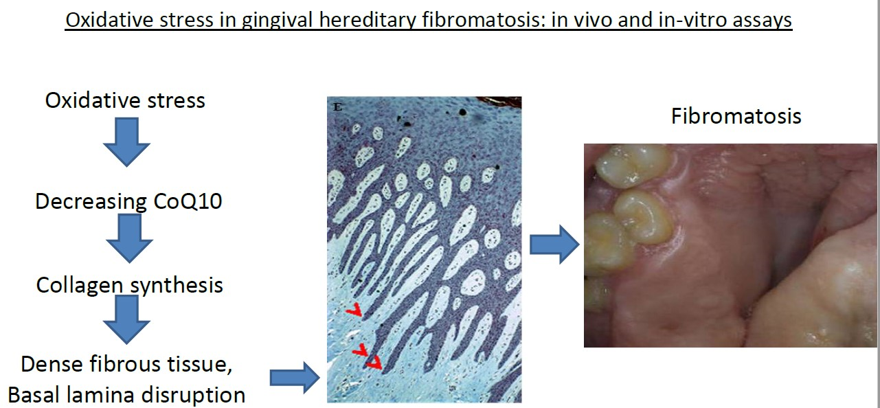 Diseases | Free Full-Text | Fibroblasts Collagen Production and  Histological Alterations in Hereditary Gingival Fibromatosis