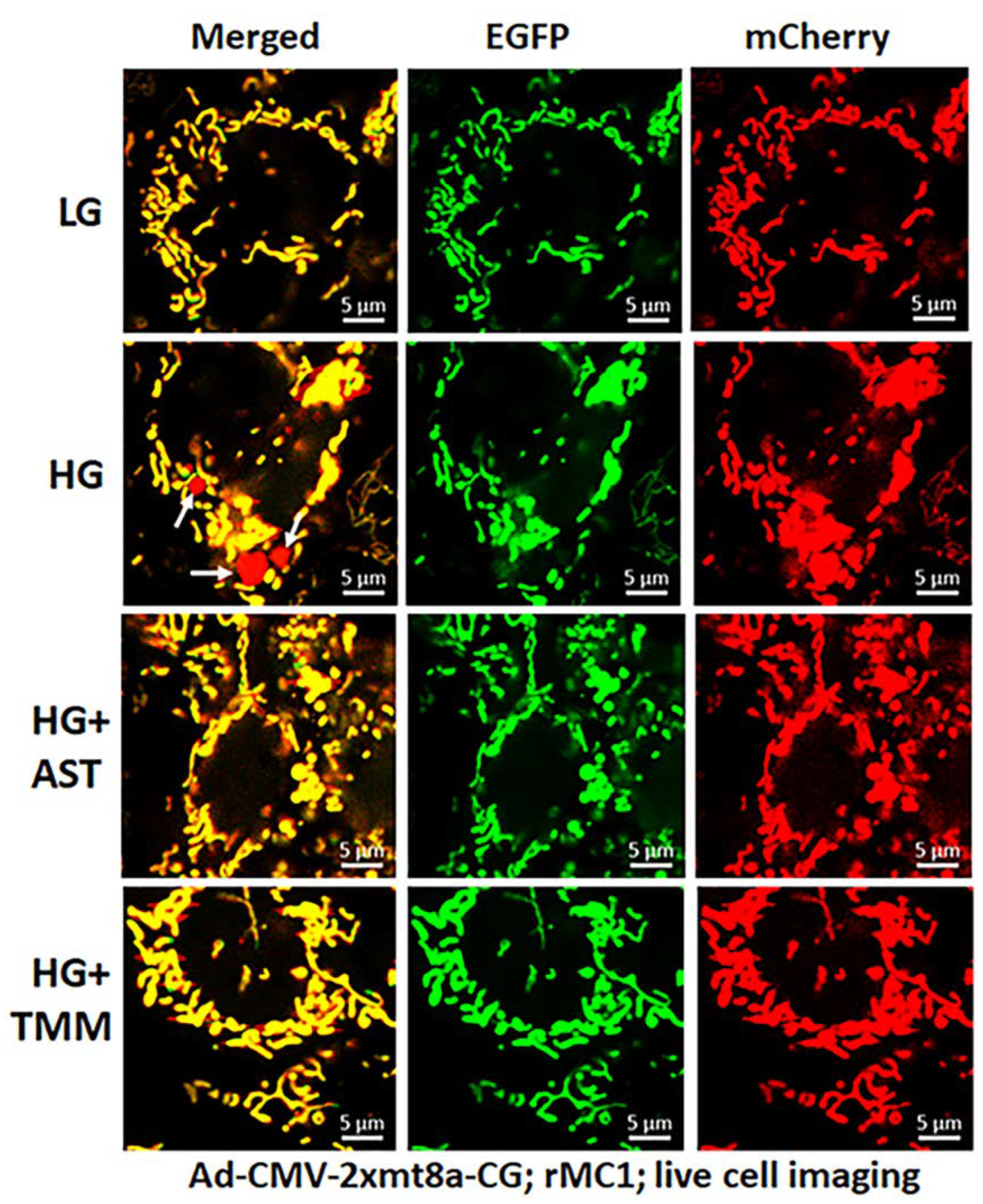 Diseases | Free Full-Text | Potential Combination Drug Therapy to Prevent  Redox Stress and Mitophagy Dysregulation in Retinal M&uuml;ller Cells under  High Glucose Conditions: Implications for Diabetic Retinopathy