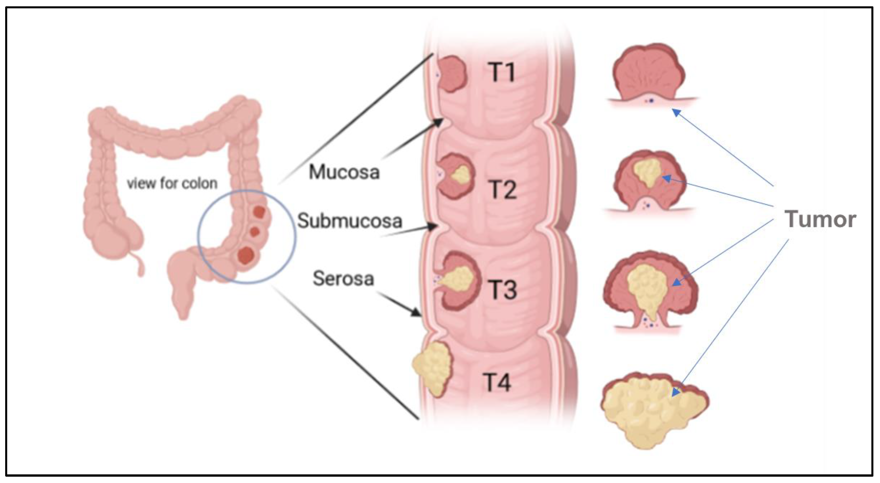 Diseases 11 00148 g004