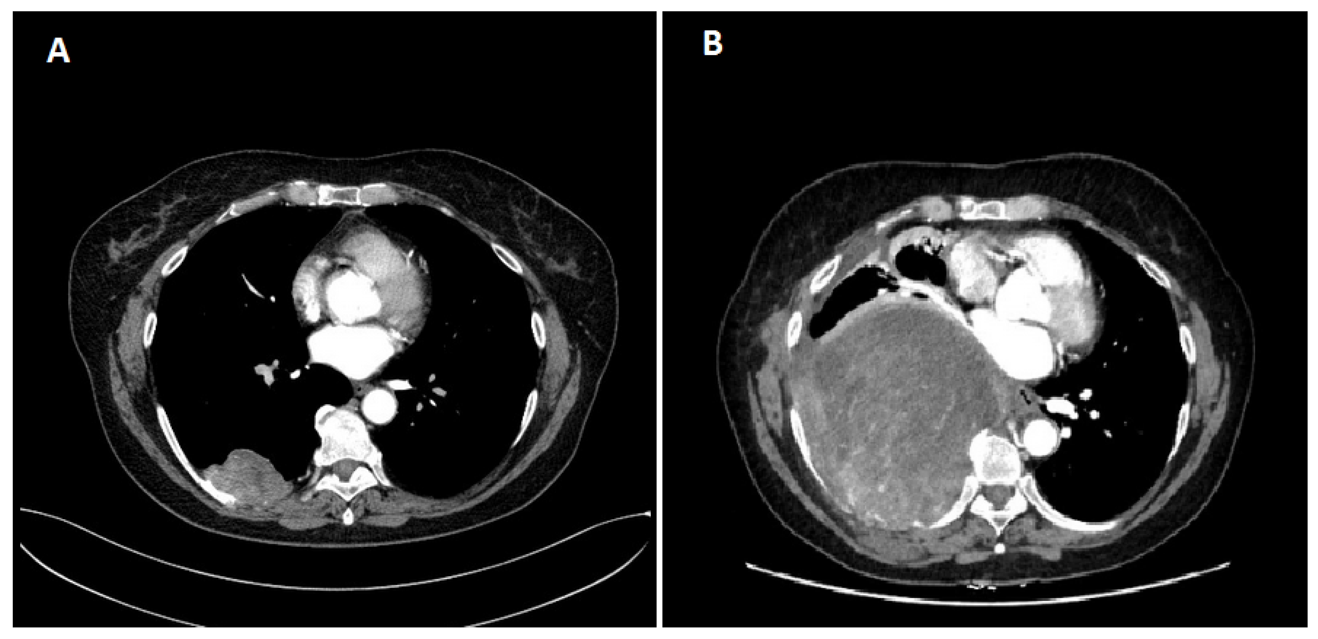 Diseases 12 00181 g001 Diseases 12 00181 g001