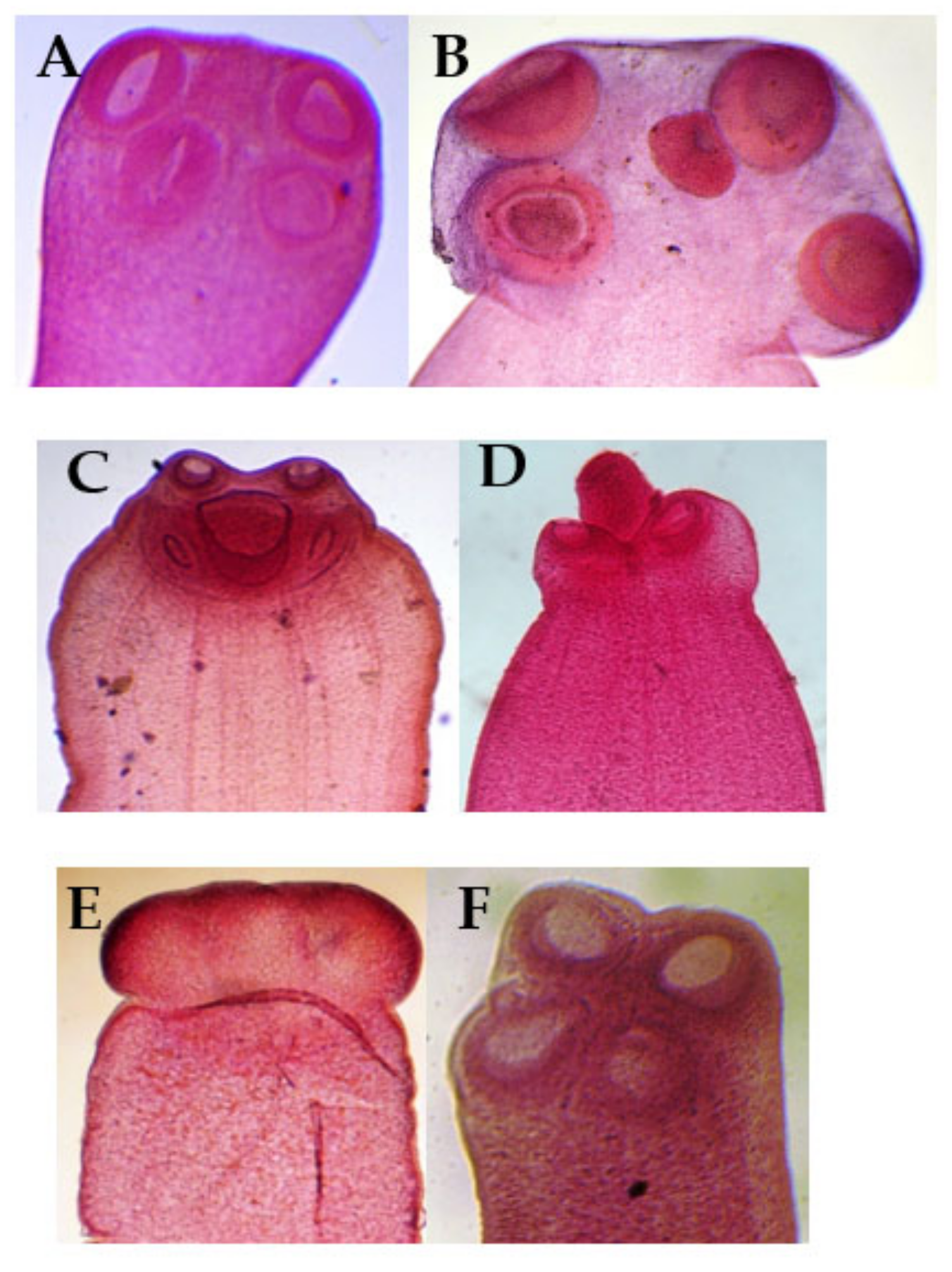 . Annals of tropical medicine and parasitology. Parasites. Annals Irop.  Med. cf rarasit Flate Y .;. Fix. 18 KiK. 1!» FiK. 20 Fig. 21 A SUDANESE  MADUROMVCOSIS. Please note that these images are extracted from scanned  page images that may have been