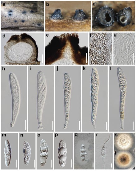 Diversity | Free Full-Text | Crassoascoma gen. nov. (Lentitheciaceae ...