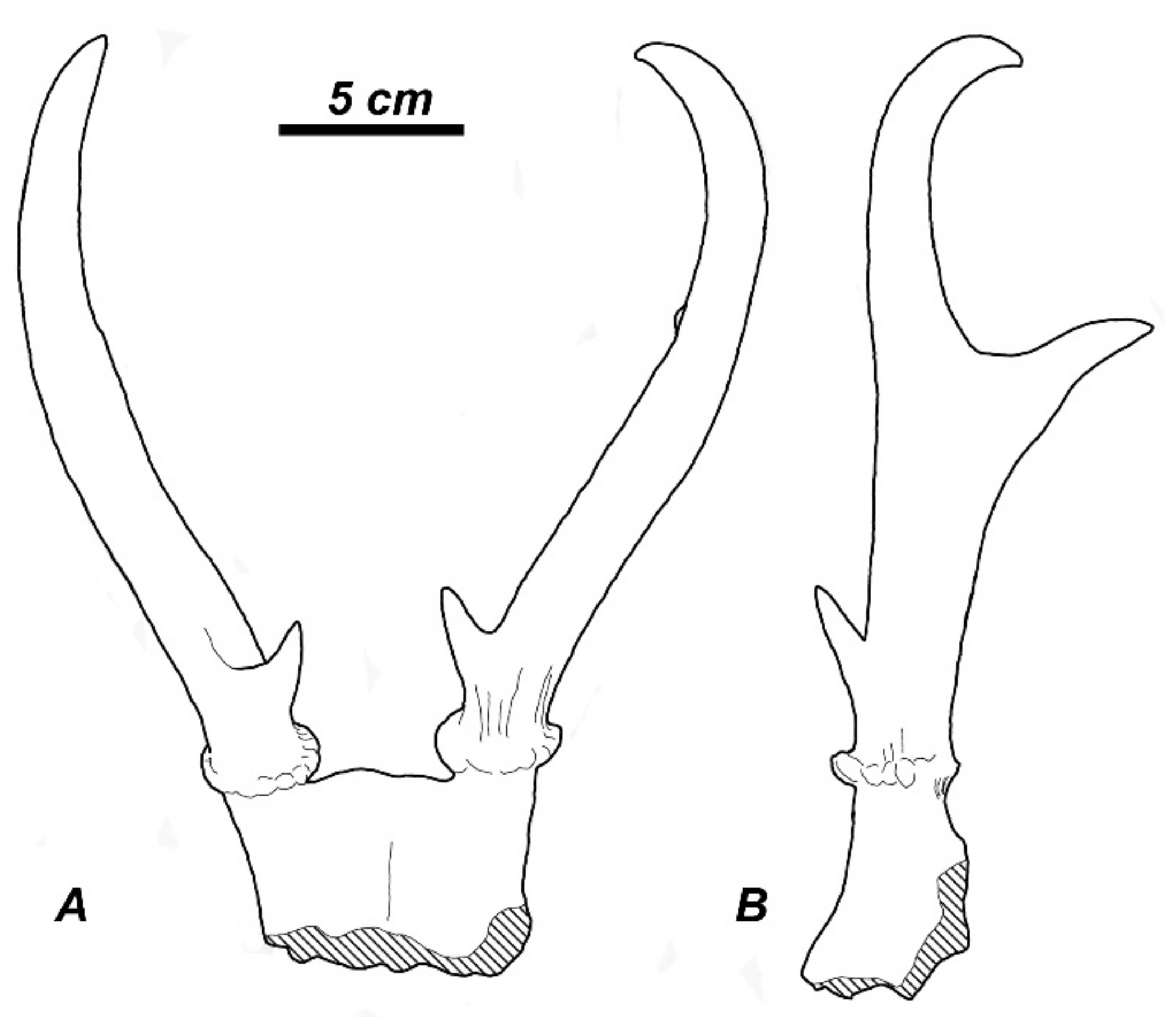  Human Humerus 2 Pieces, Earth-Tone Brown Relic, Left