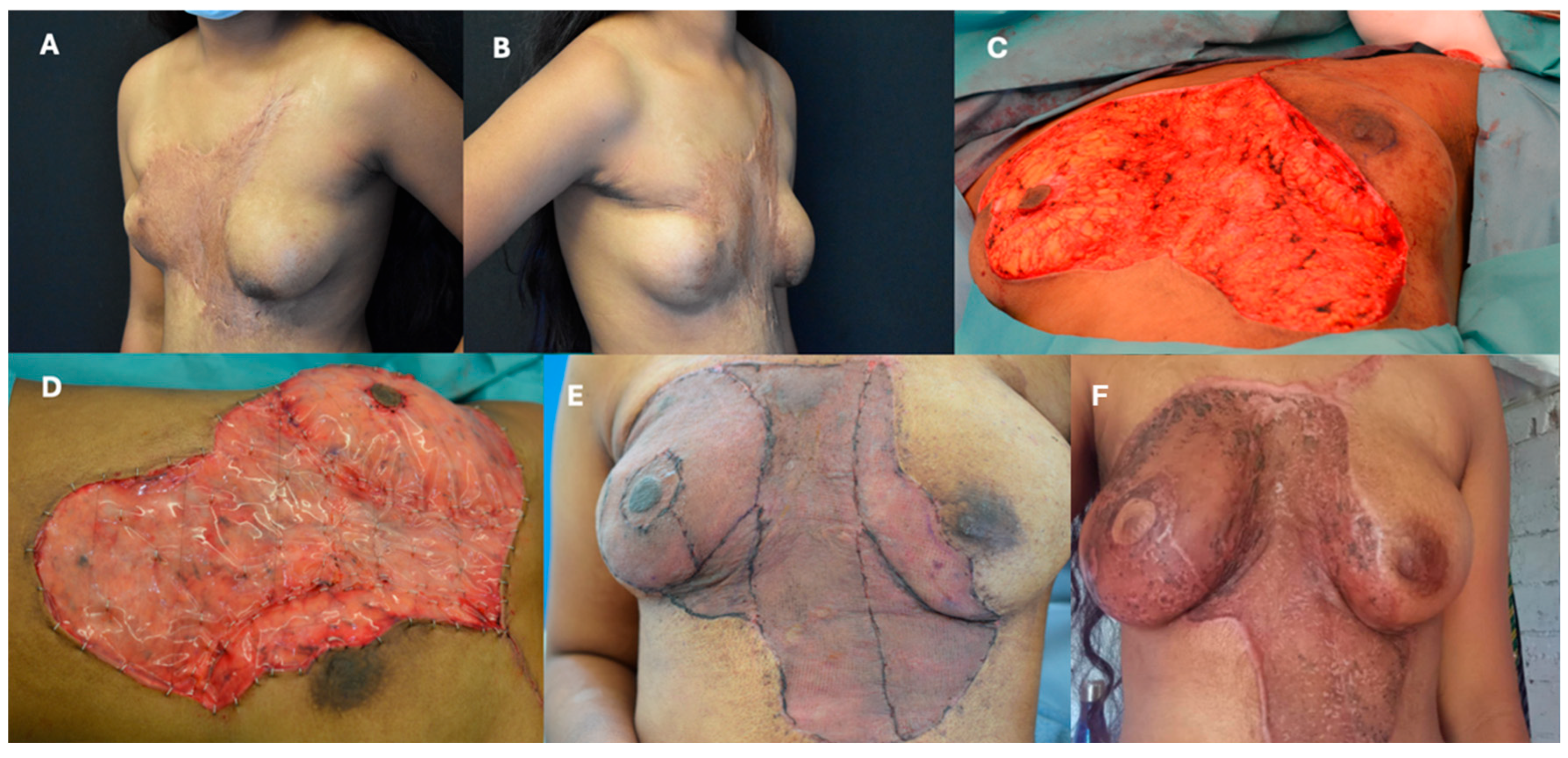 Ebj 06 00045 g002 Ebj 06 00045 g002