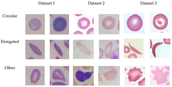 Red Cell Staining (Color) • The Blood Project