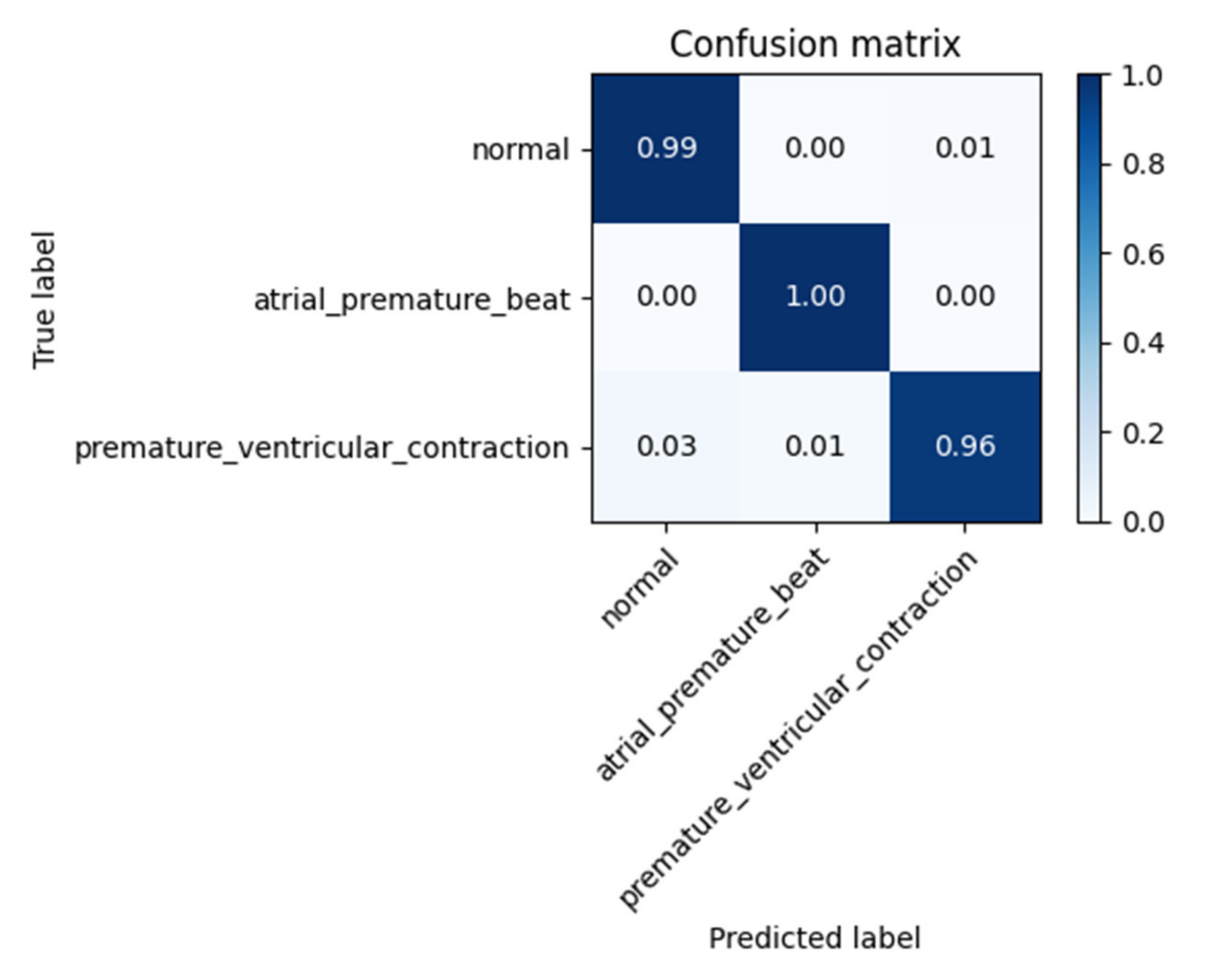 Confusion matrix