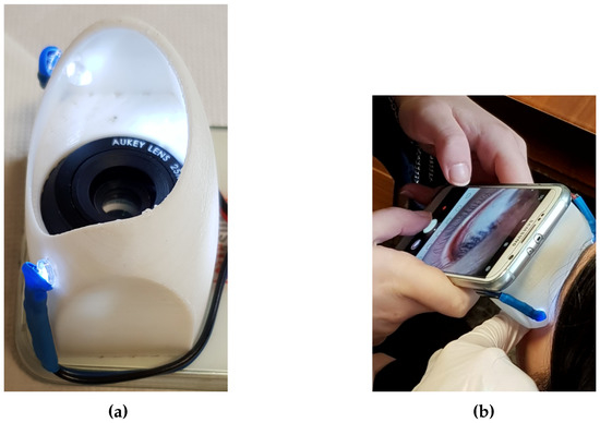 Electronics | Free Full-Text | Novel Biased Normalized Cuts Approach for  the Automatic Segmentation of the Conjunctiva