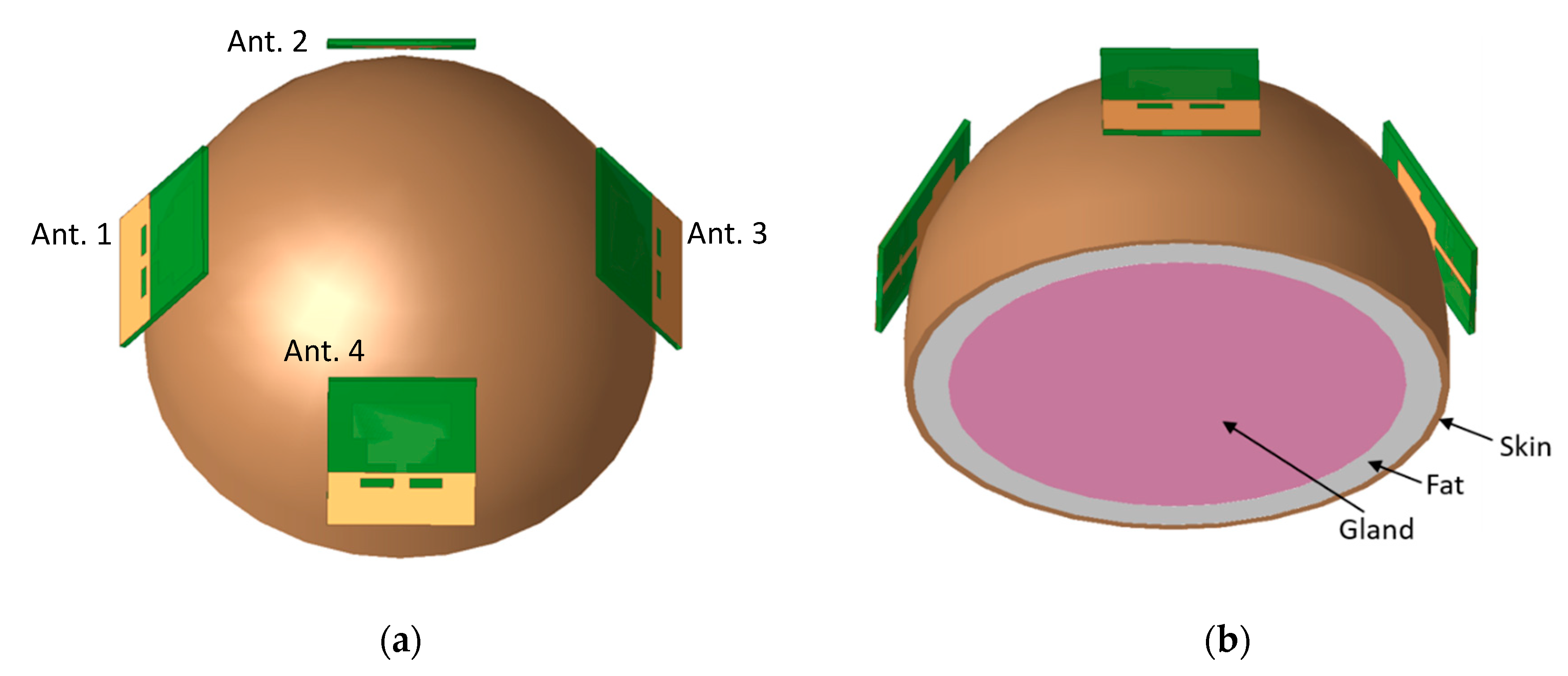 Electronics 10 00304 g017