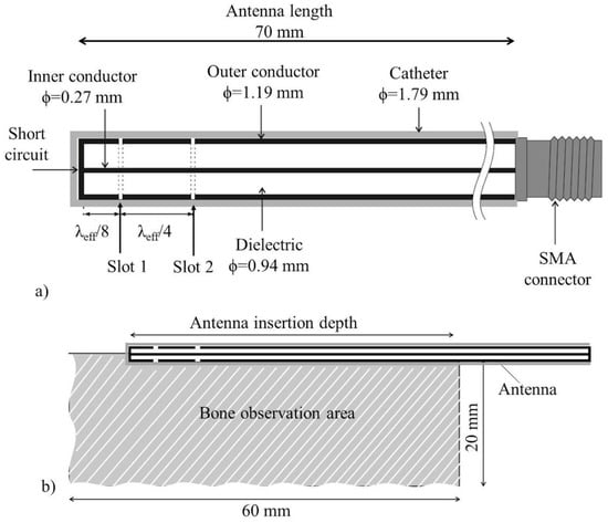 https://www.mdpi.com/electronics/electronics-10-00761/article_deploy/html/images/electronics-10-00761-g001-550.jpg