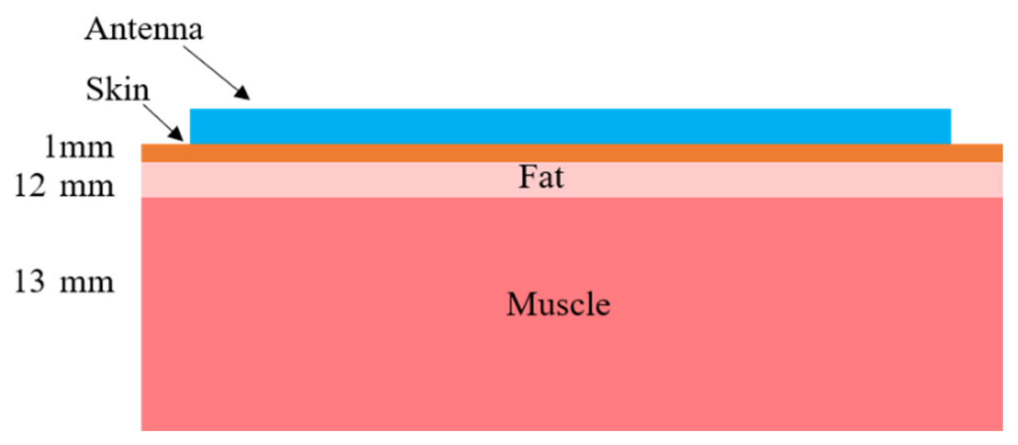 Electronics 10 00994 g011 Electronics 10 00994 g011