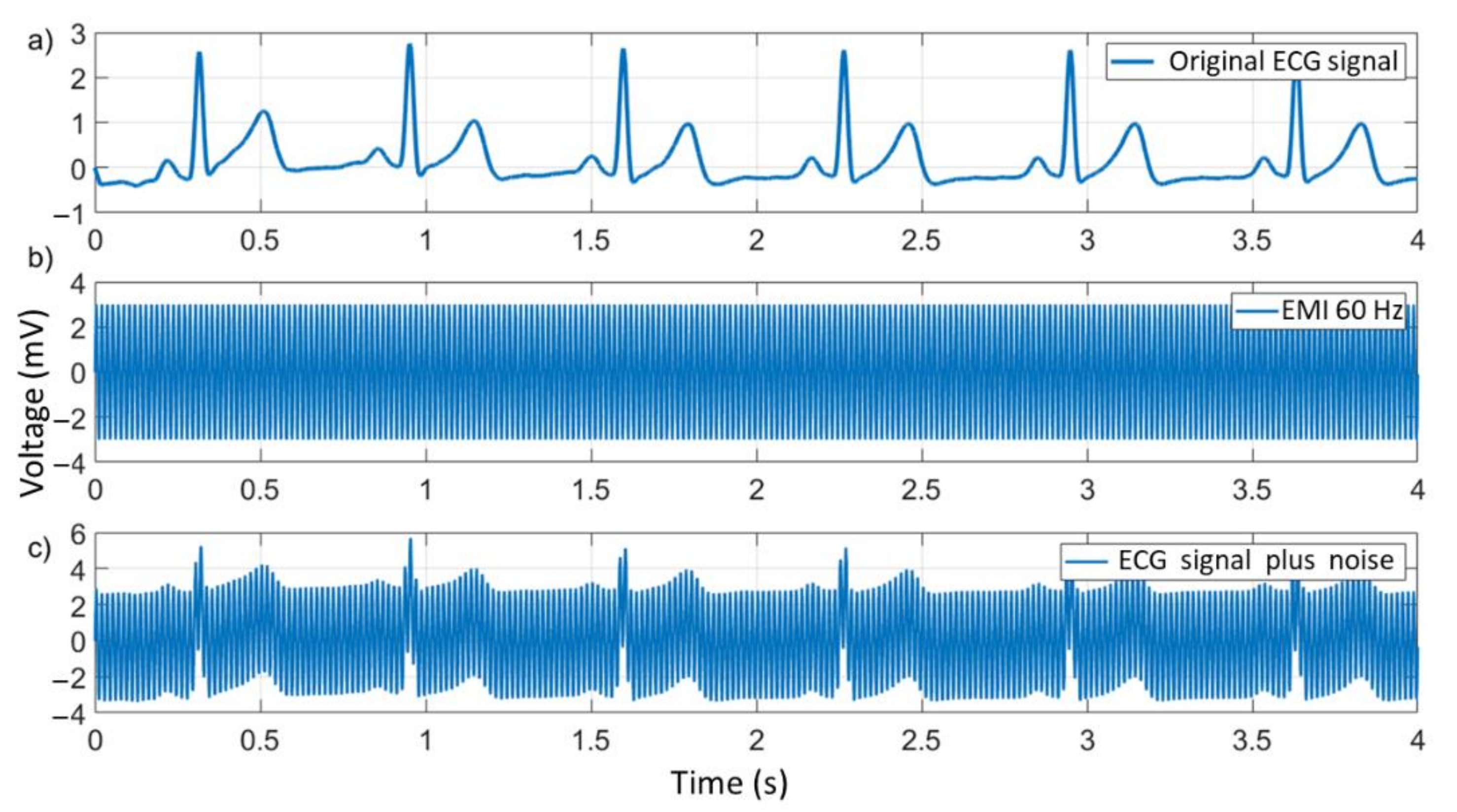 Electronics | Free Full-Text | Improved Noise Cancelling Algorithm for  Electrocardiogram Based on Moving Average Adaptive Filter