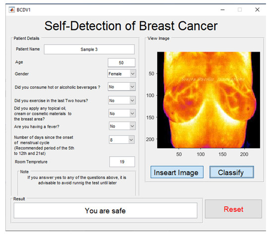 PDF) Wearable infra-red pre-screening smartbra for early detection of breast  cancer