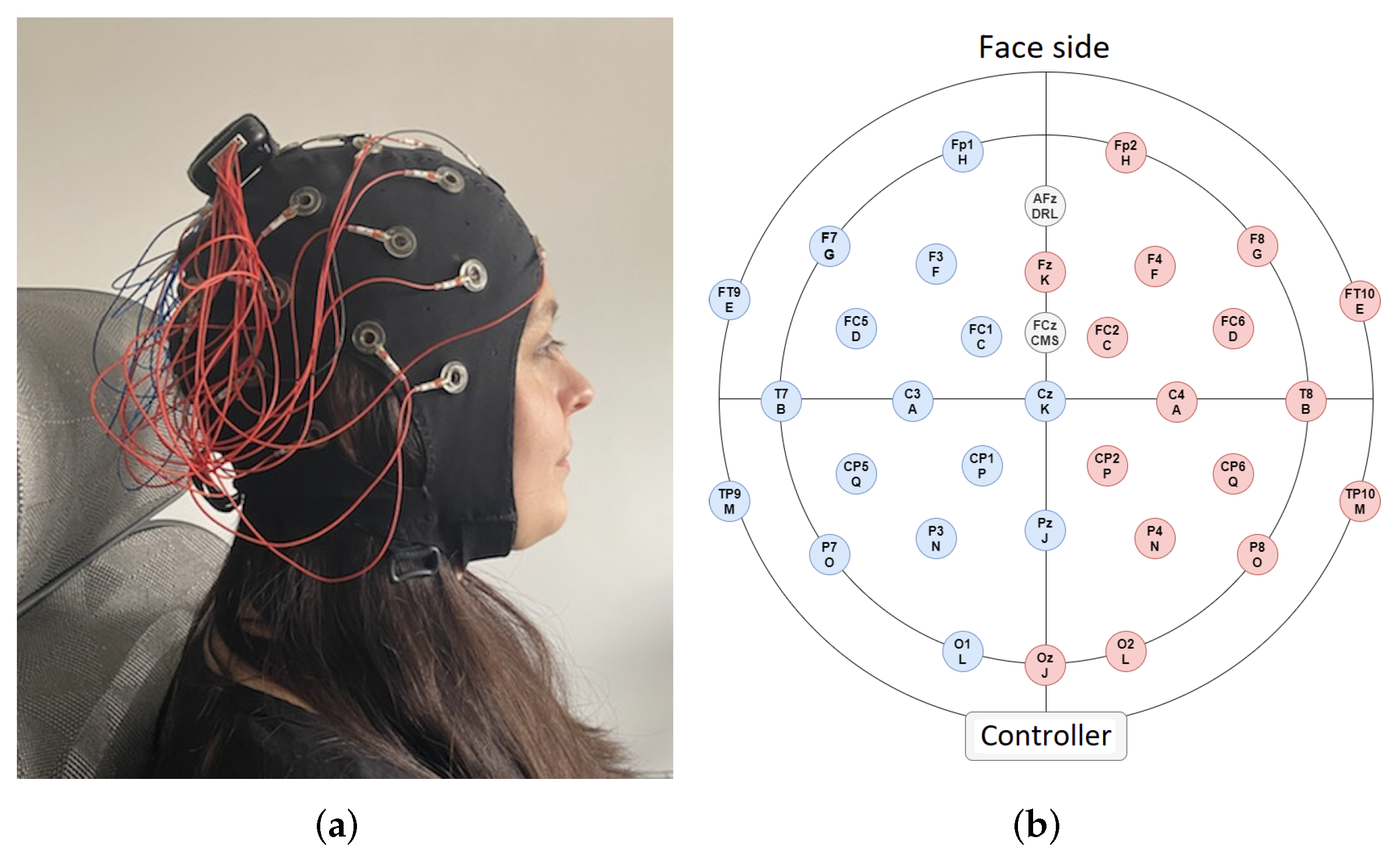 eeg electrode placement