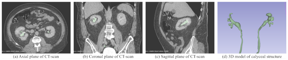 Electronics 11 01562 g005