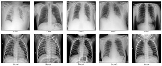 Synthetic COVID-19 CXR Dataset Dataset