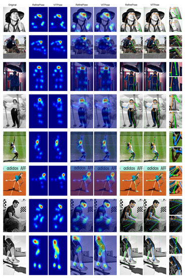 AI based pose detection for physical rehabilitation software