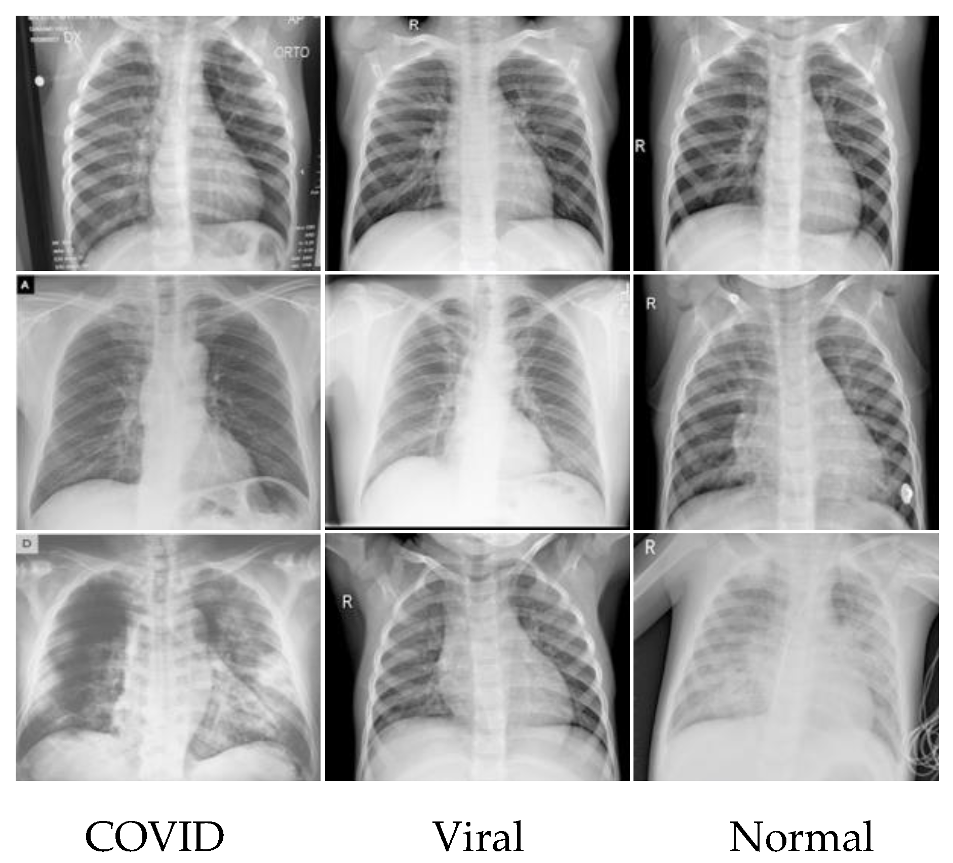 Electronics | Free Full-Text | A Novel COVID-19 Image Classification ...