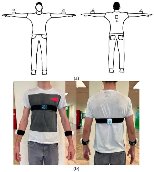 Electronics | Free Full-Text | Harmonic Distortion Aspects in Upper Limb  Swings during Gait in Parkinson&rsquo;s Disease