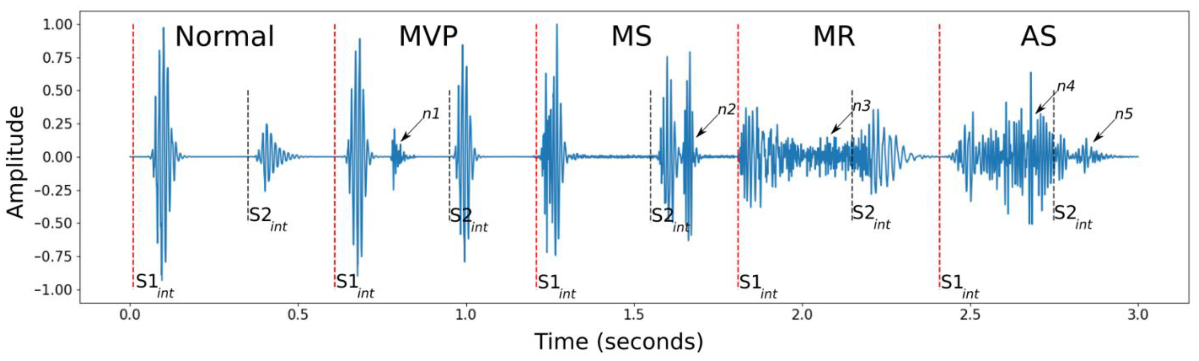 Among Us Emergency Meeting Sound Effect Free Download MP3, Pure Sound E