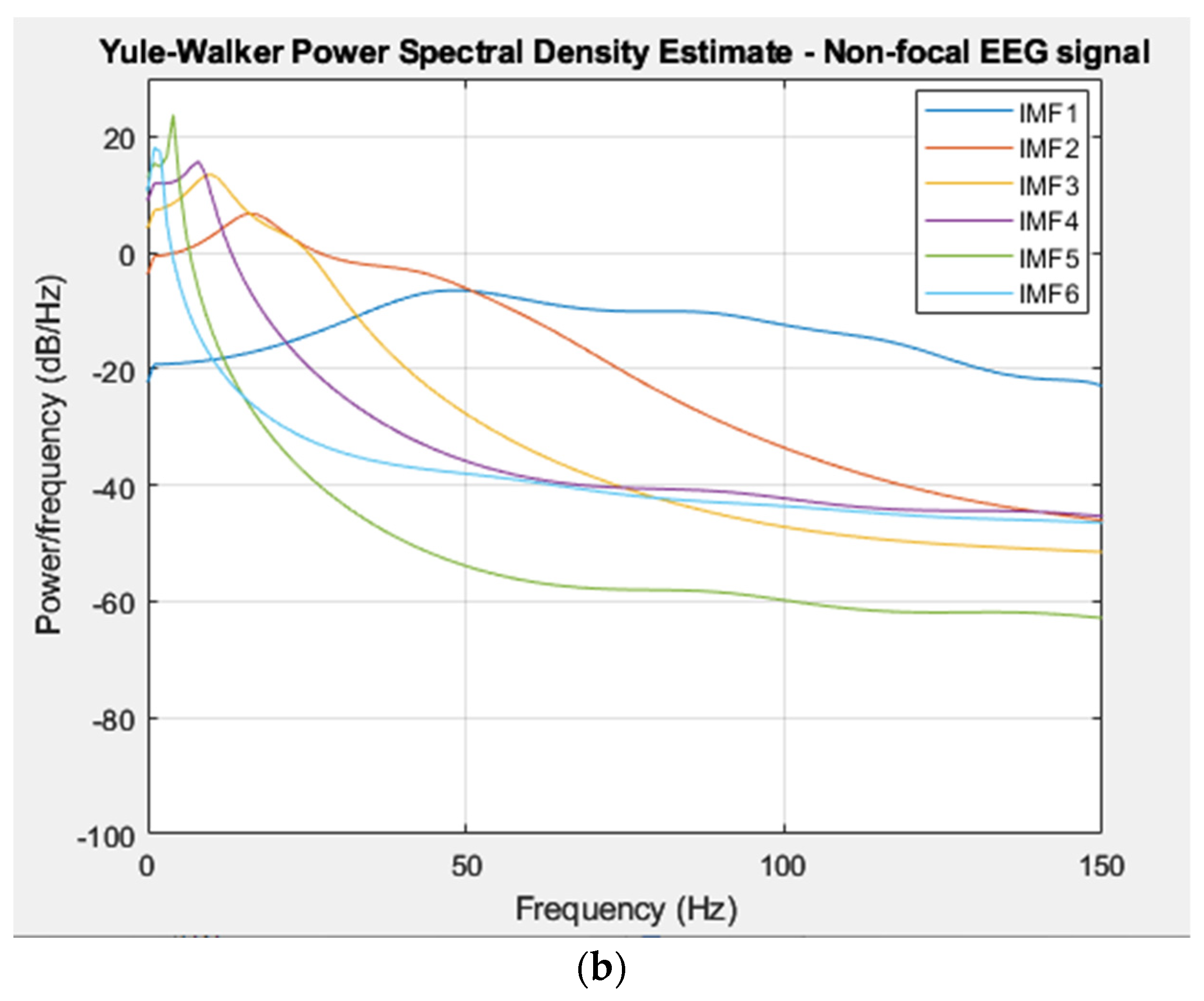 Electronics | Free Full-Text | A Novel Automated Empirical Mode ...