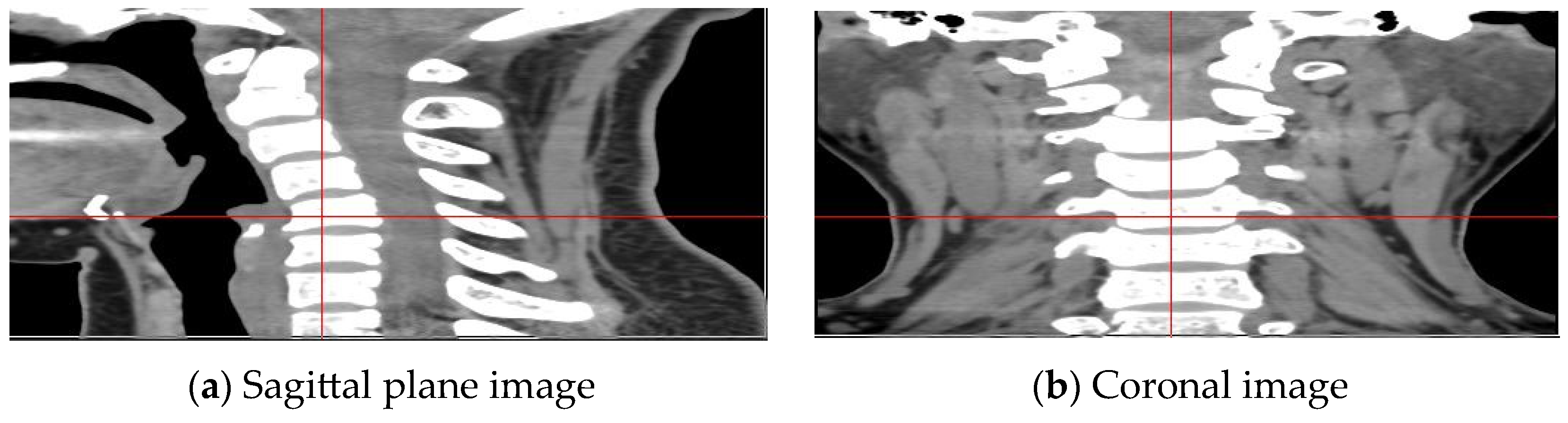 Electronics 13 00432 g006