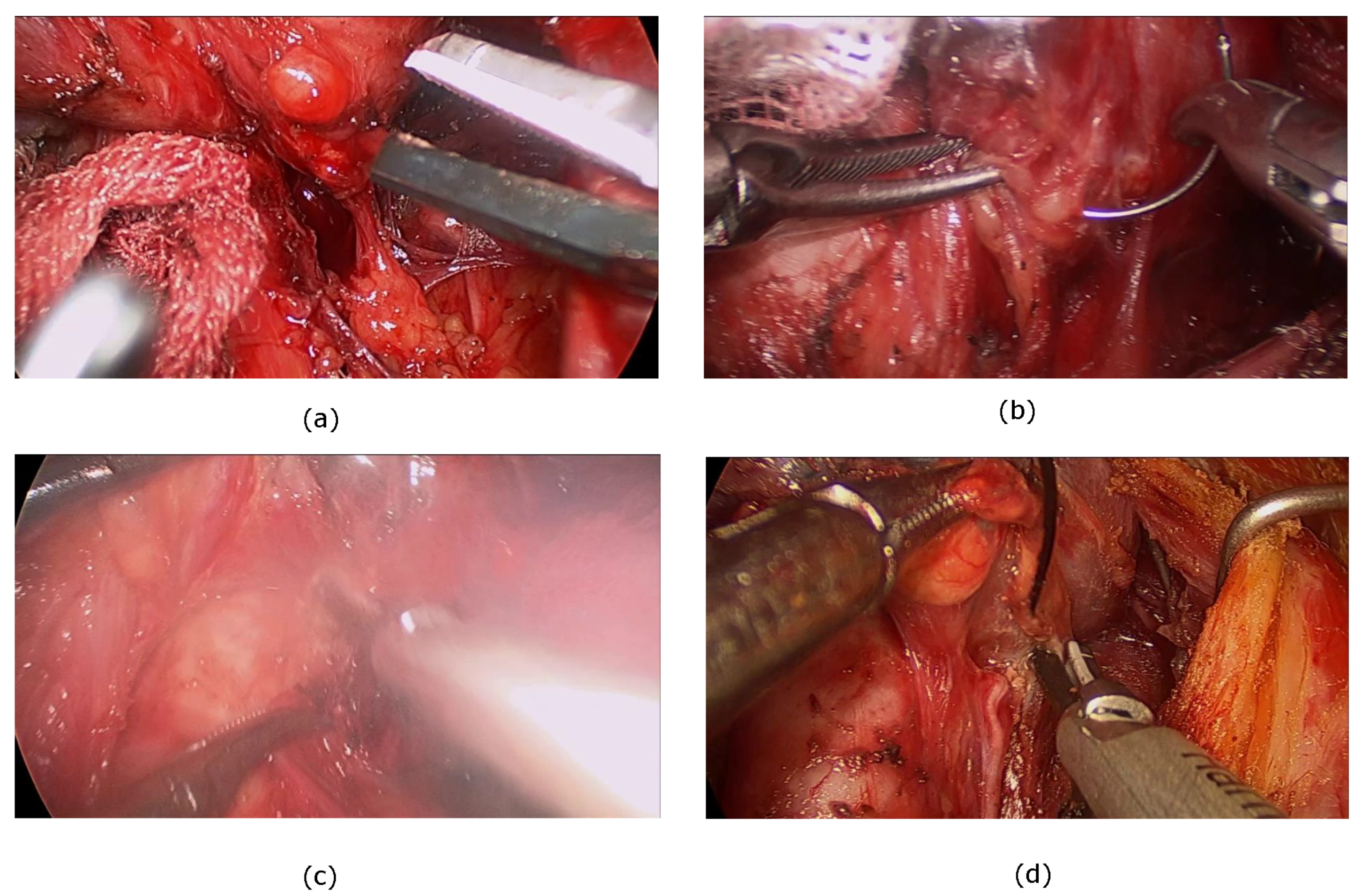 Electronics 14 01092 g007