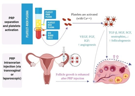 PRP_process