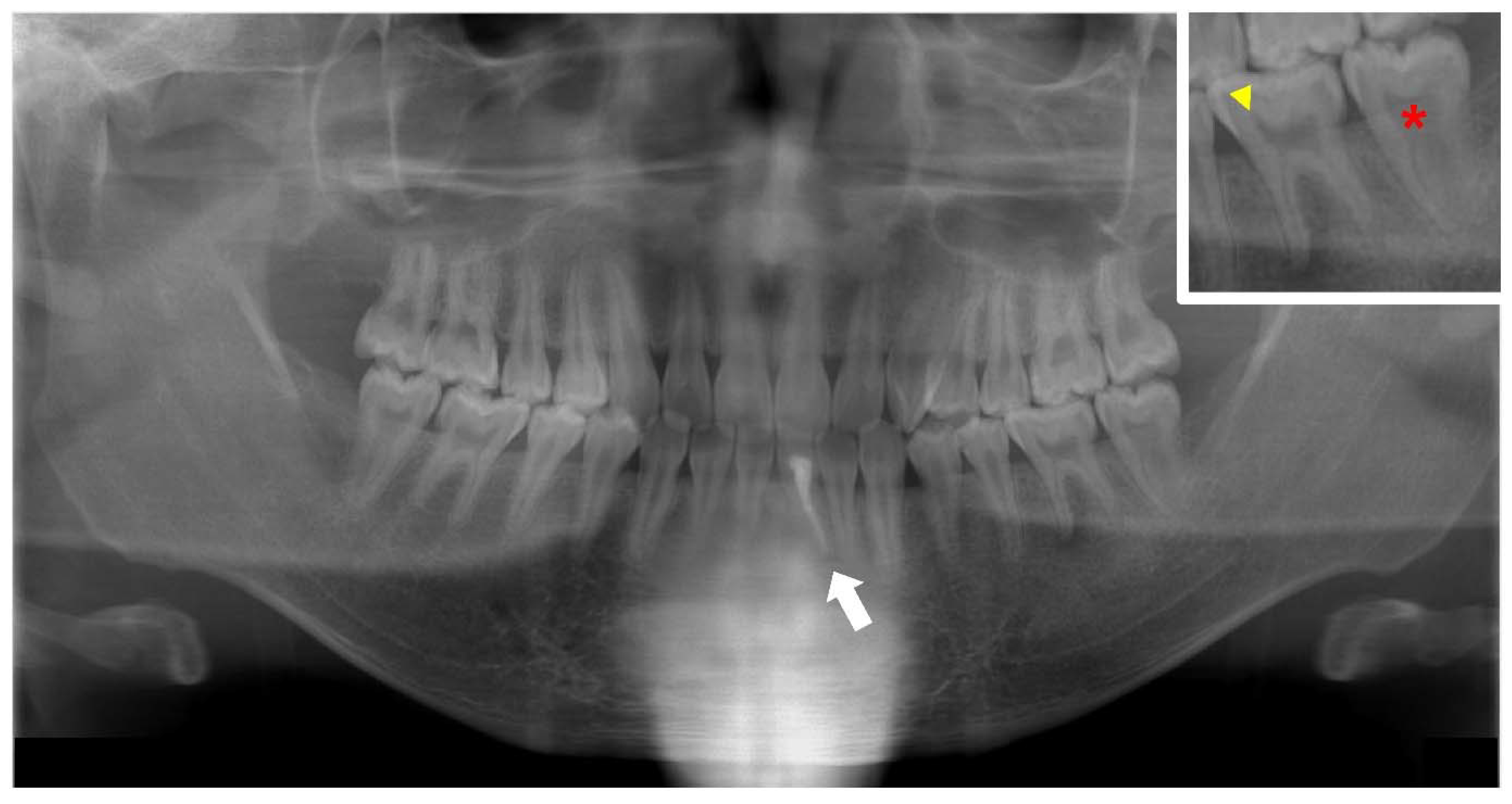 Endocrines 03 00056 g007 Endocrines 03 00056 g007