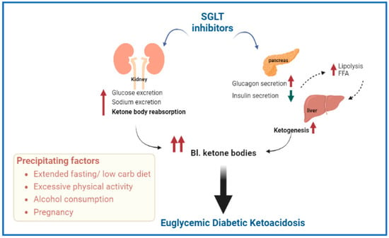 Endocrines | Free Full-Text | Diabetic Ketoacidosis Management: Updates and  Challenges for Specific Patient Population