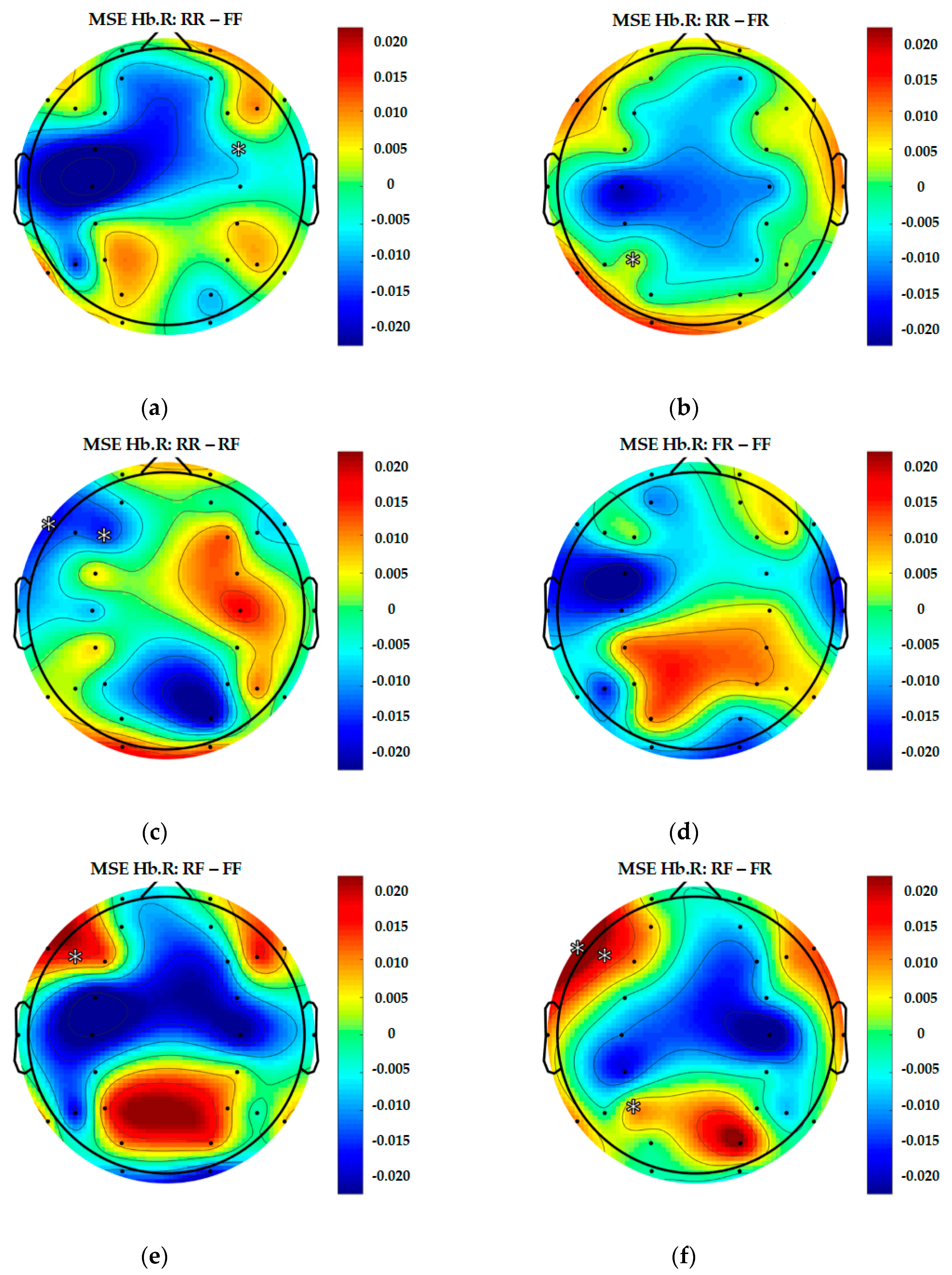 Entropy Free Full Text Multiscale Entropy As A New Feature For Eeg And Fnirs Analysis Html