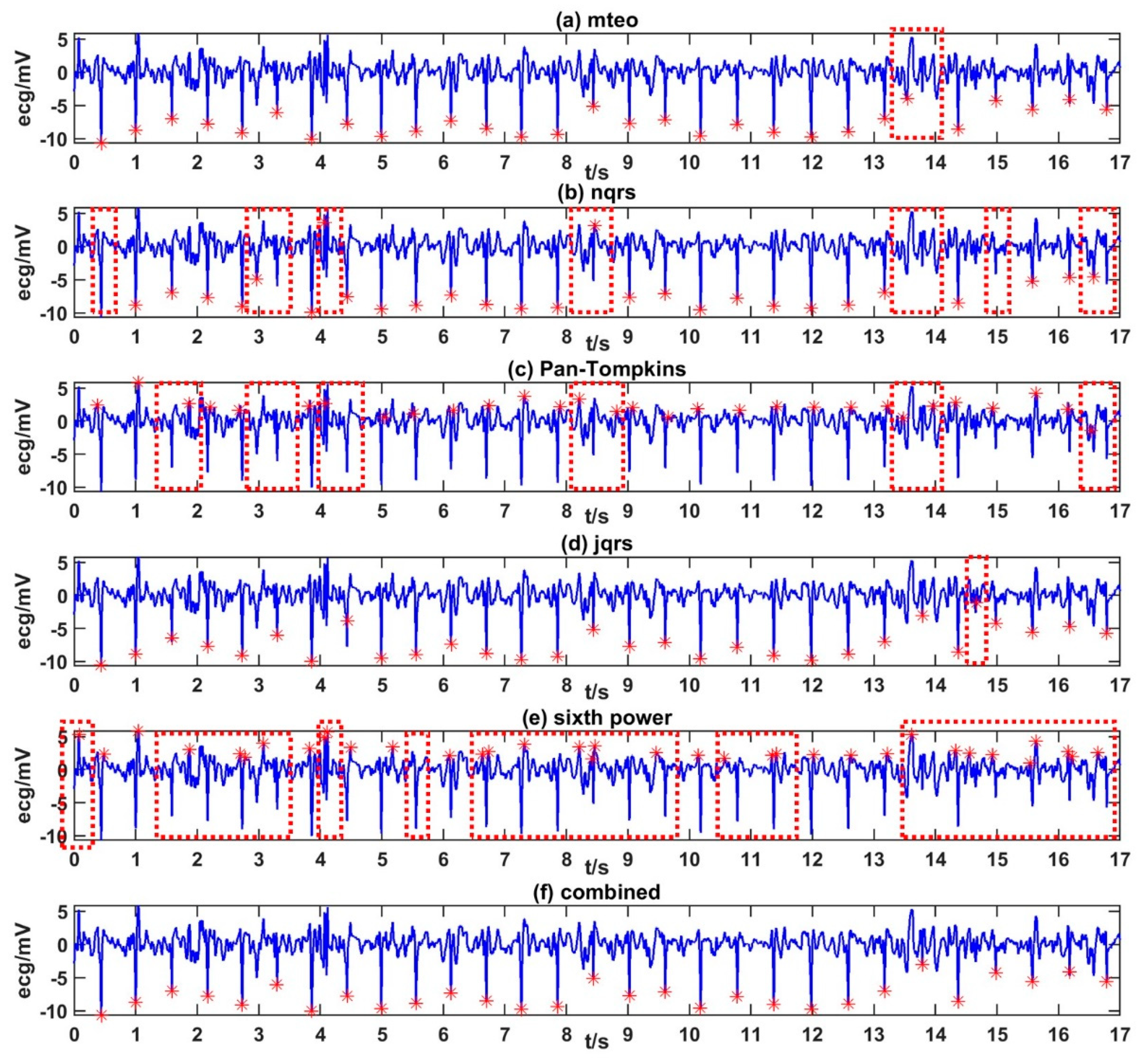 Alcohol Can Tank HRV, Resting Heart Rate, and Sleep