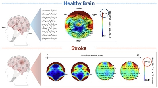 Entropy | Free Full-Text | EEG Fractal Analysis Reflects Brain Impairment  after Stroke