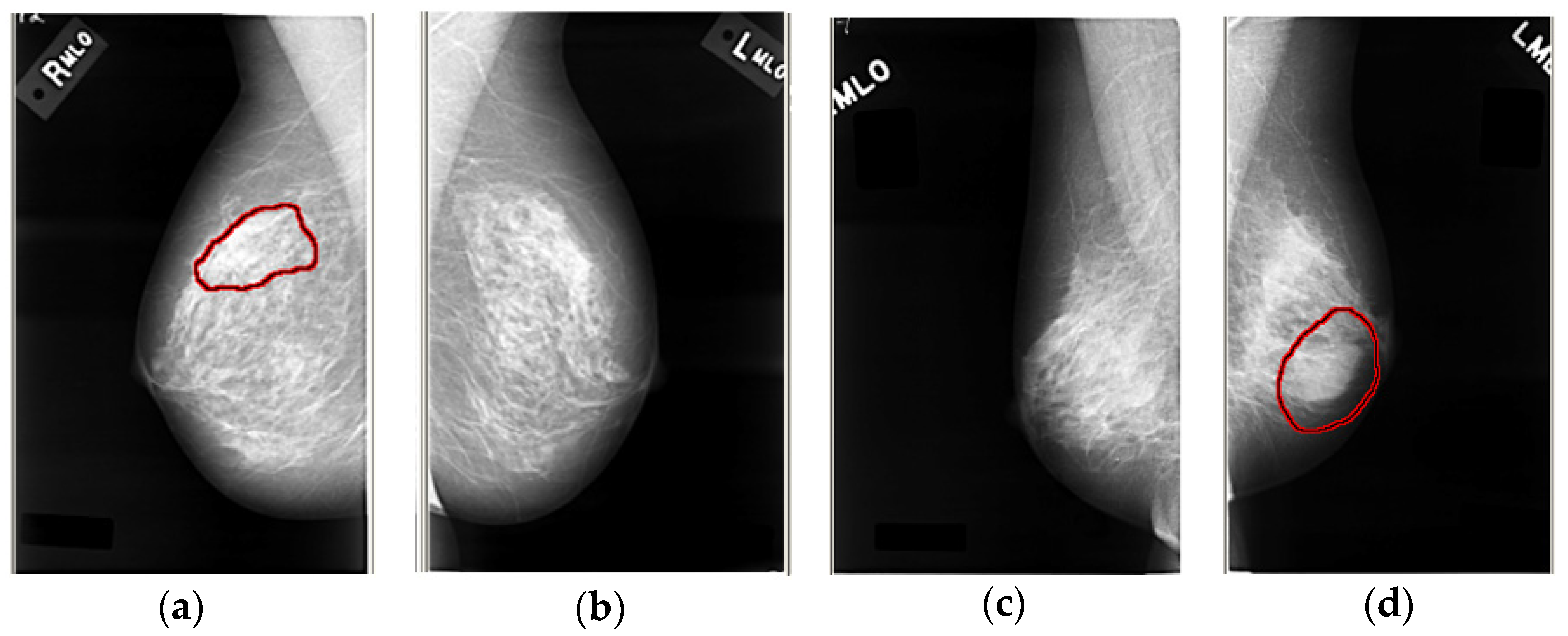 Calibrated Digital Mammography Scale