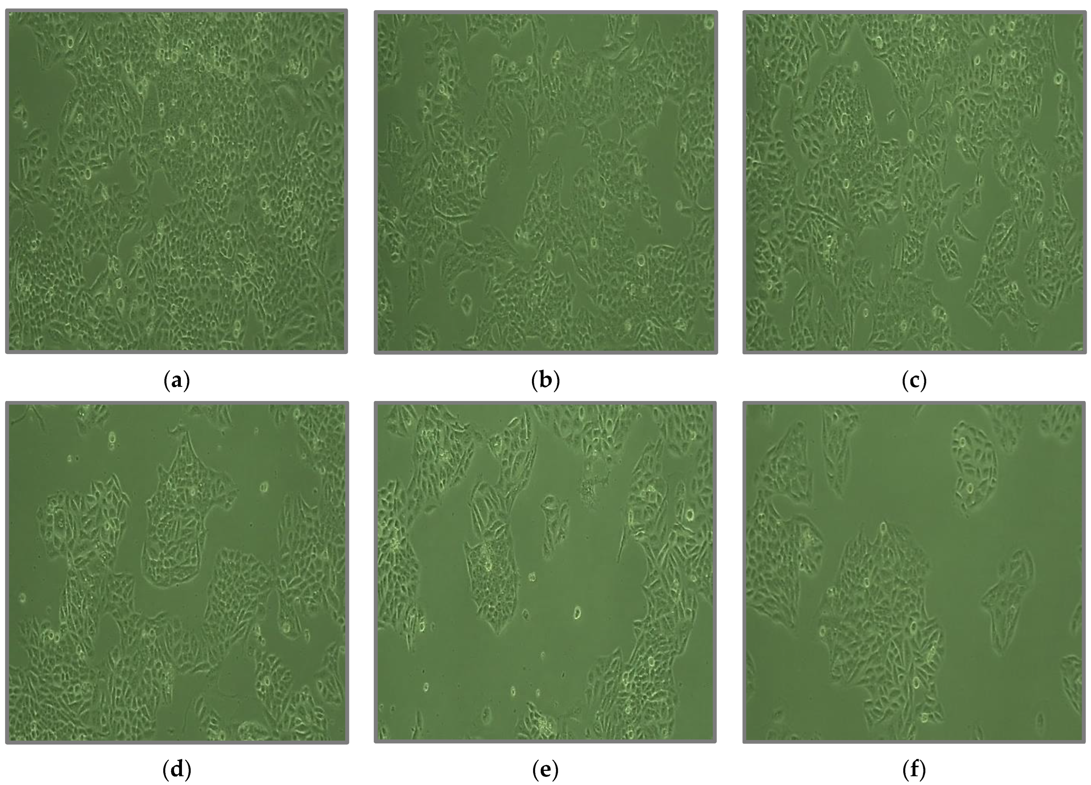 Fermentation 08 00677 g011 Fermentation 08 00677 g011