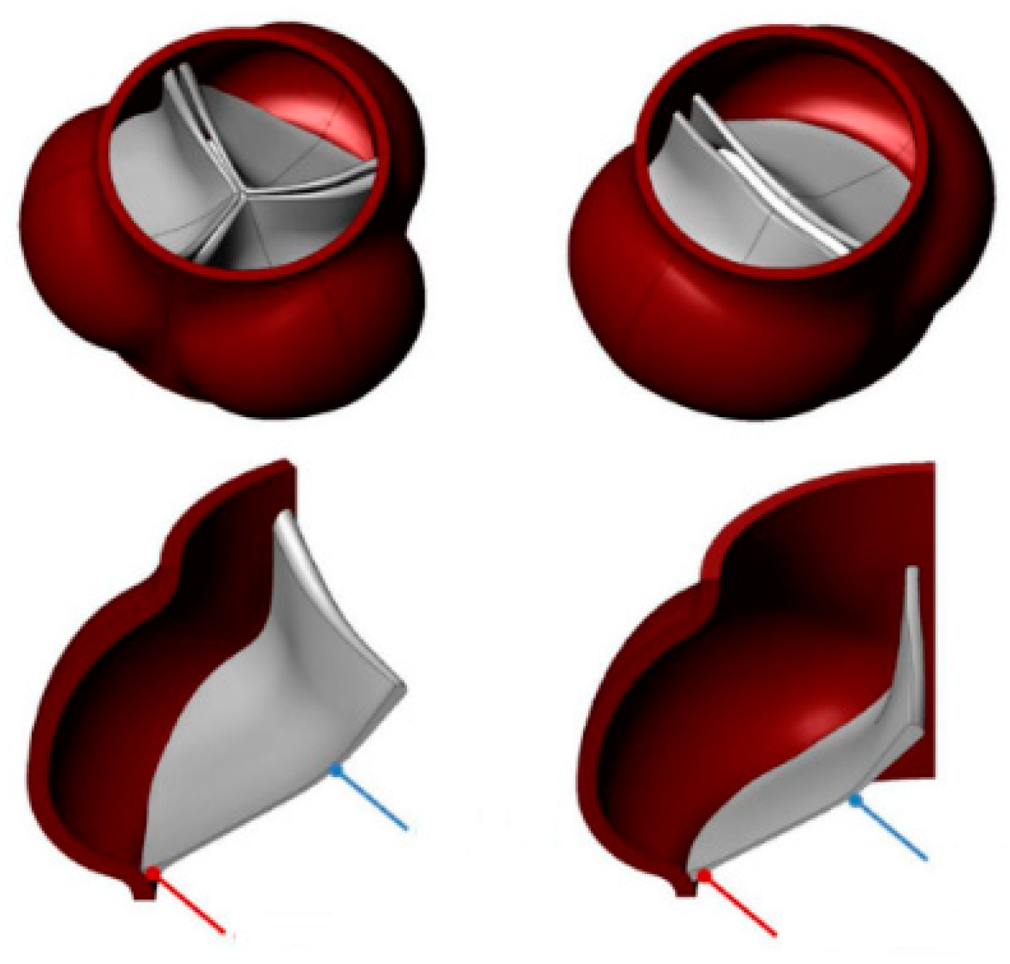 A turbulence in vitro assessment of On-X and St Jude Medical prostheses -  ScienceDirect