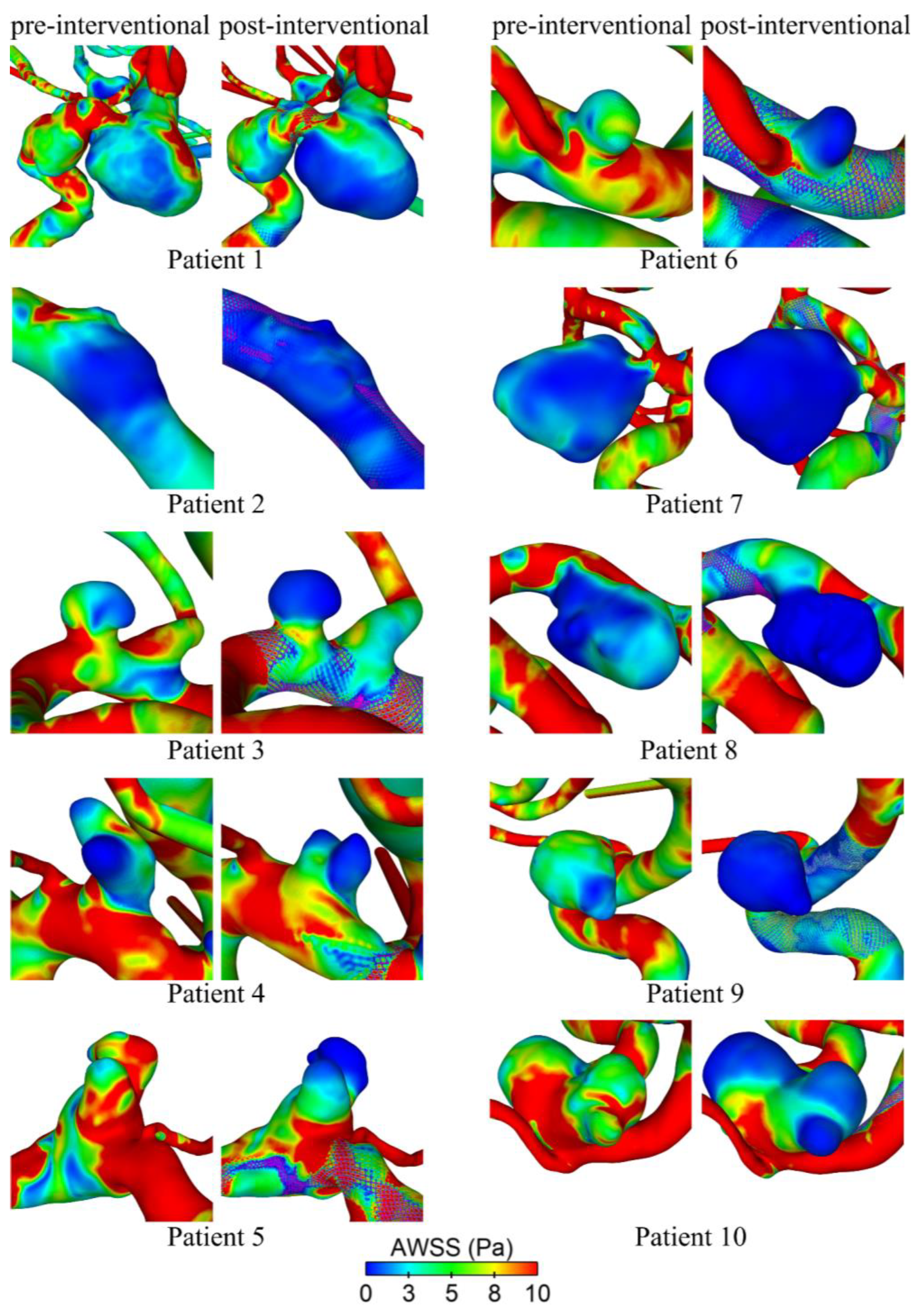 Fluids 09 00055 g004