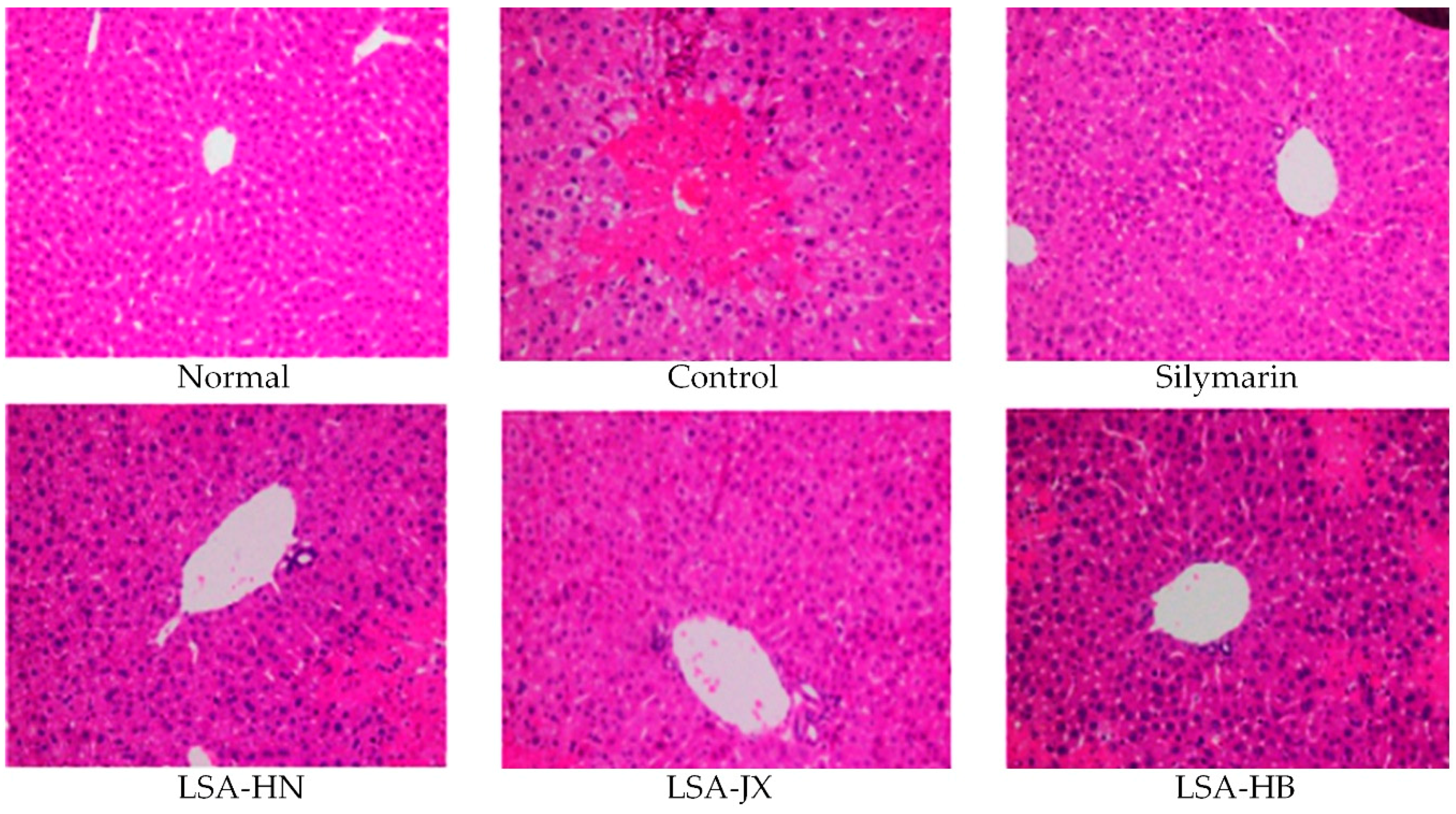 Foods Free Full Text Preventive Effect Of Alkaloids From Lotus Plumule On Acute Liver Injury In Mice