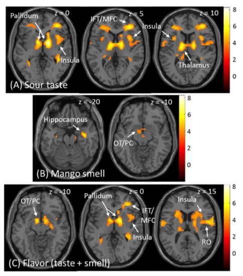 https://www.mdpi.com/foods/foods-10-02034/article_deploy/html/images/foods-10-02034-g004-550.jpg