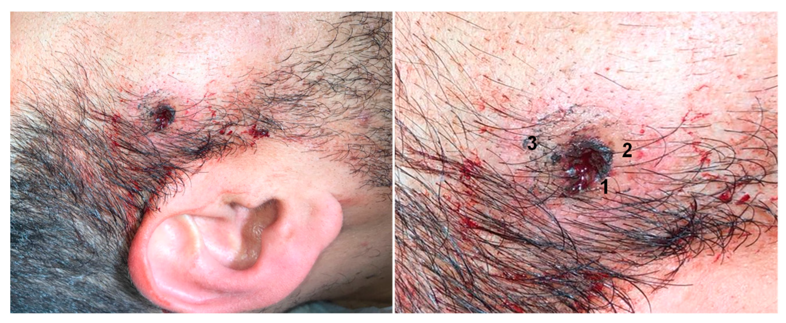 Forensicsci 02 00008 g001