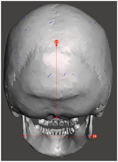 Forensic Sciences | Free Full-Text | Population-Inclusive Assigned