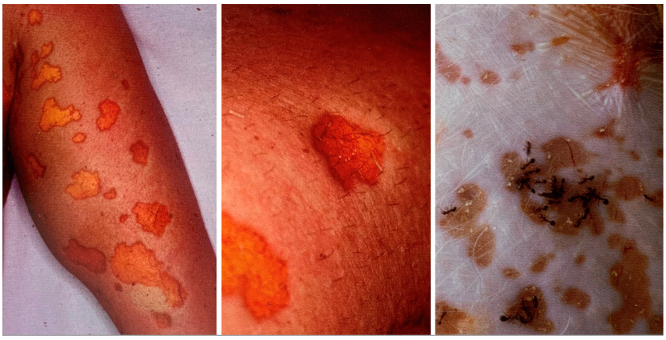 Forensicsci 02 00054 g002 Forensicsci 02 00054 g002