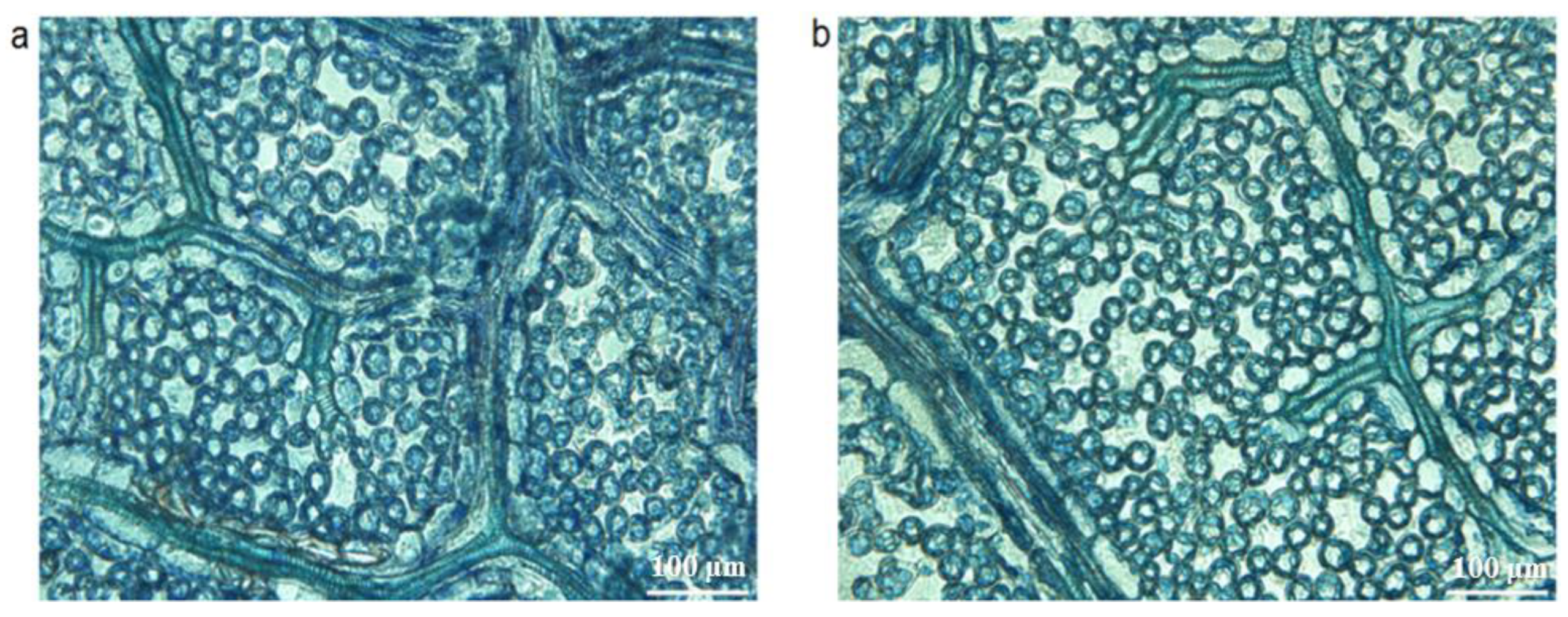 Forests 14 01554 g005