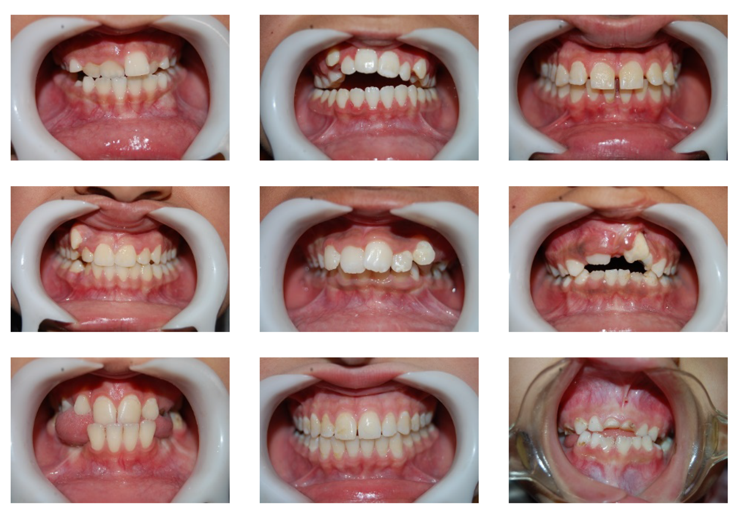 Fractalfract 06 00669 g004 Fractalfract 06 00669 g004