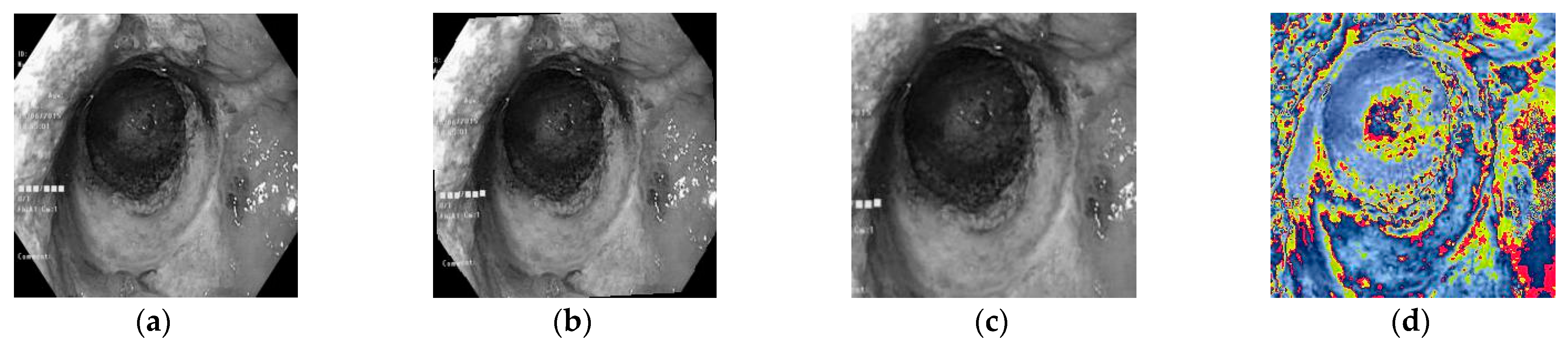 Fractalfract 09 00511 g006 Fractalfract 09 00511 g006