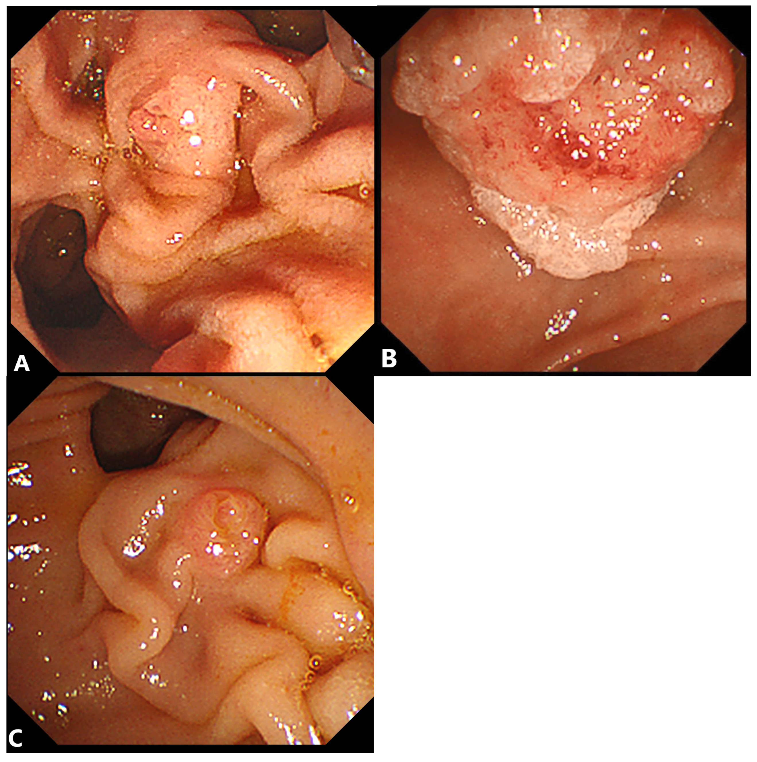 Gastroenterology Insights, Free Full-Text