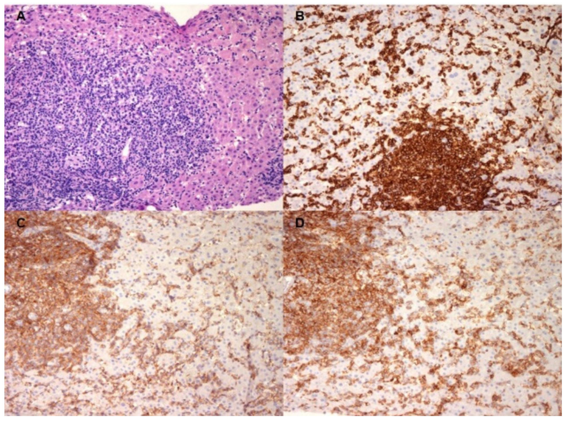 Gastroent 13 00026 g002