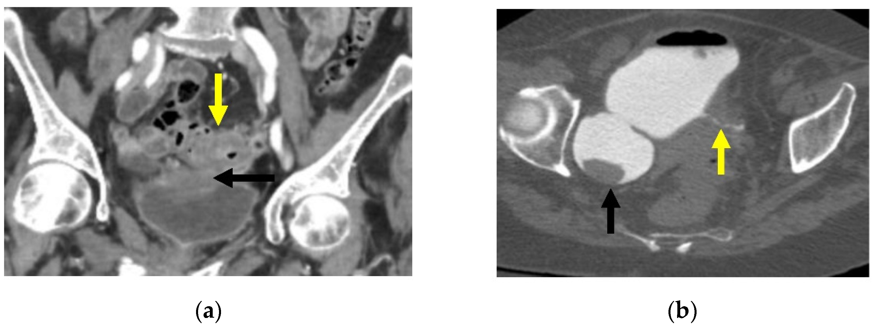 Gastroent 13 00033 g007 Gastroent 13 00033 g007