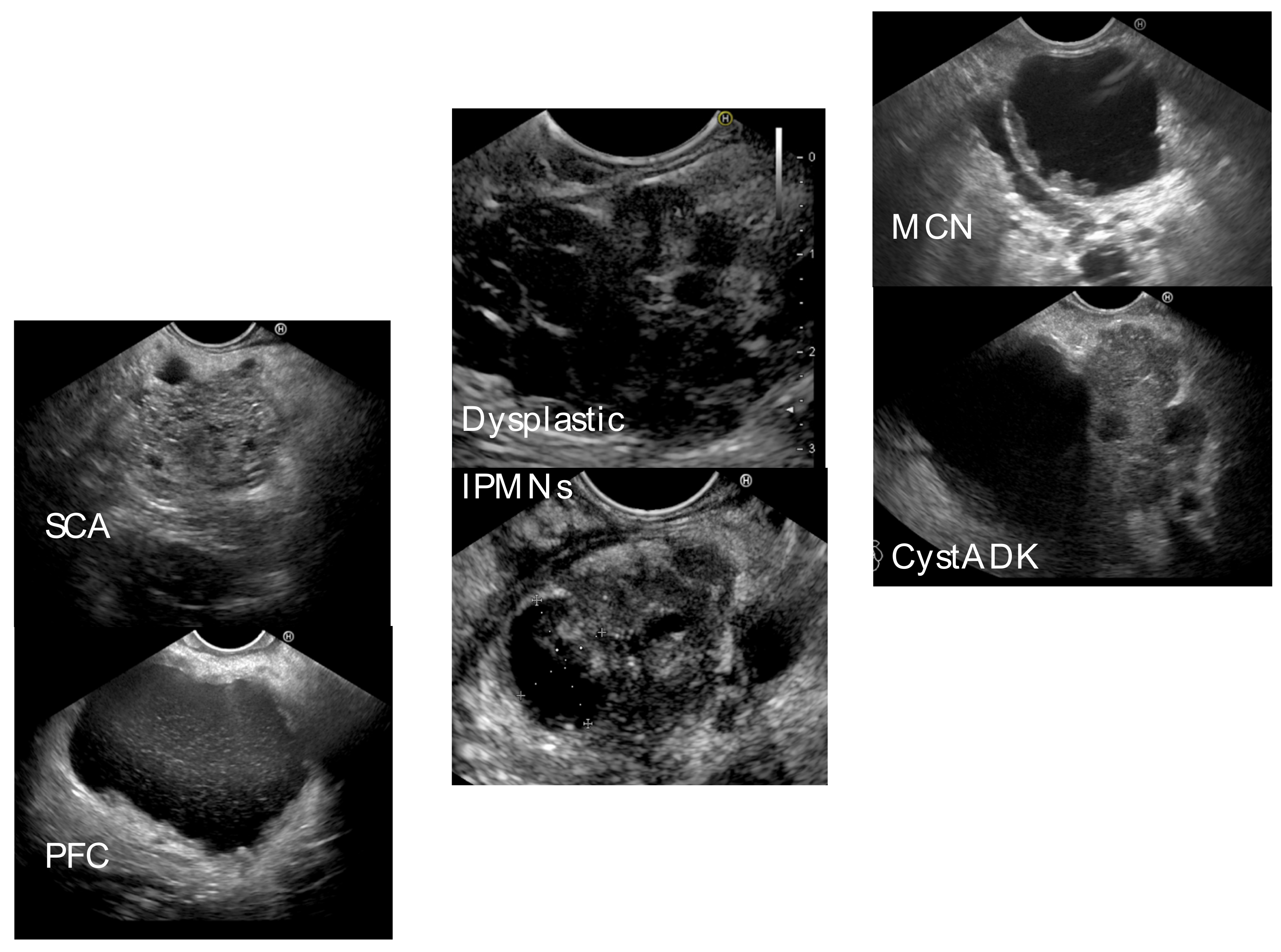 Gastroent 14 00015 g004 Gastroent 14 00015 g004
