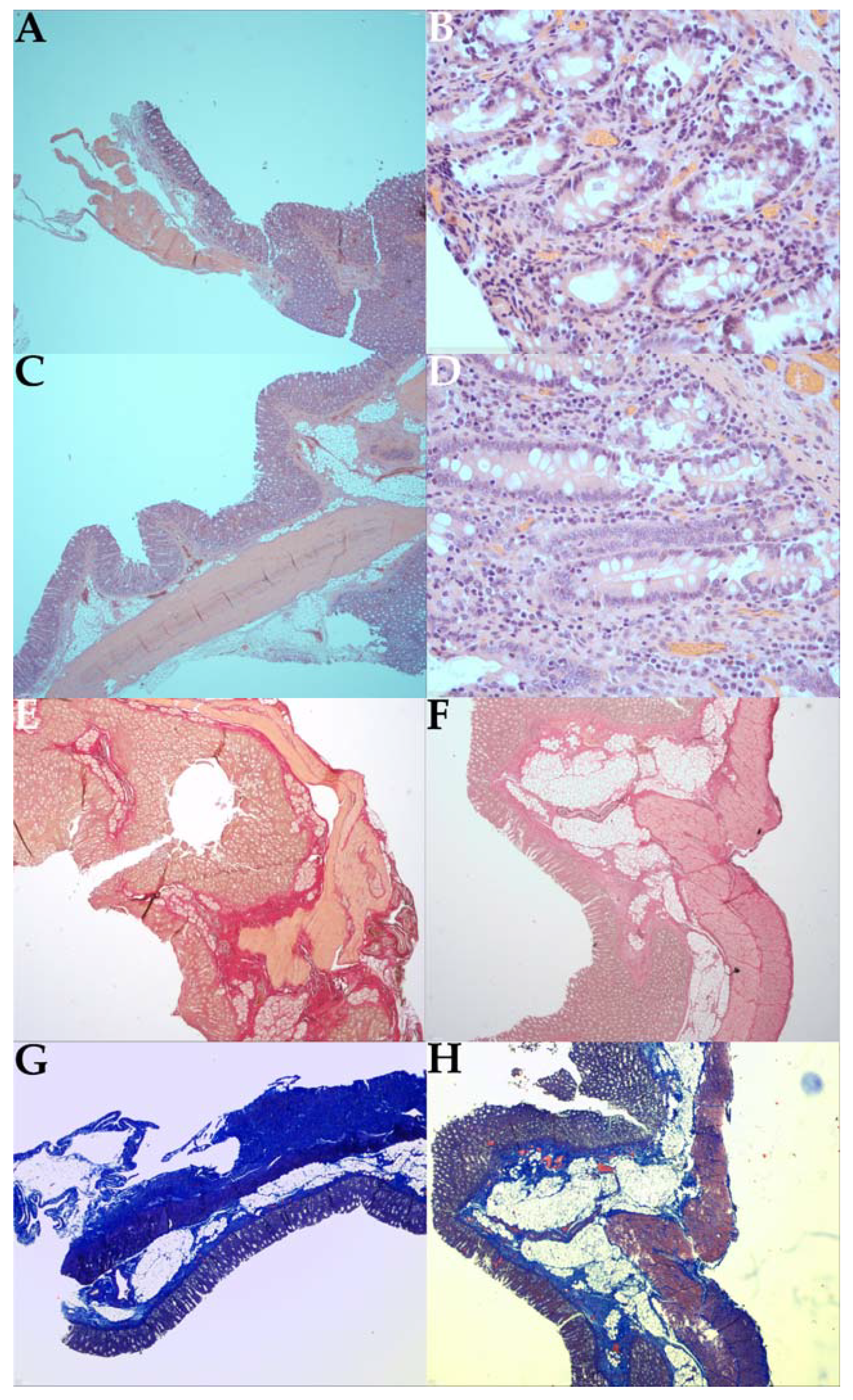 Gastroent 14 00035 g005
